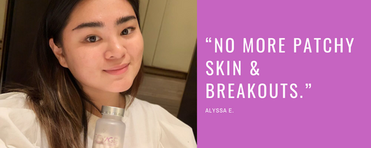 “No more patchy skin & breakouts.” - Alyssa E.