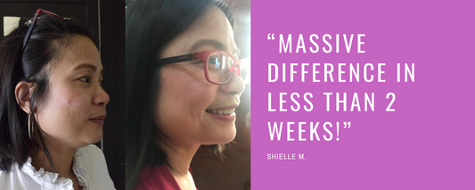 “Massive difference in less than 2 weeks!” - Shielle M.