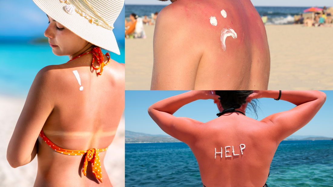 Why Is Topical Sunscreen Alone Not Enough?